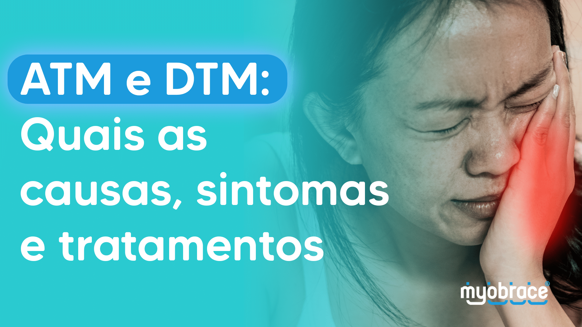 atm e dtm, dtm, atm, disfunção temporomandibular e dor orofacial, dtm o que é, atm sintomas, o que é dtm, atm o que é, disfunção temporomandibular, o que é atm, sintomas dtm, Myobrace, Odontologia Miofuncional