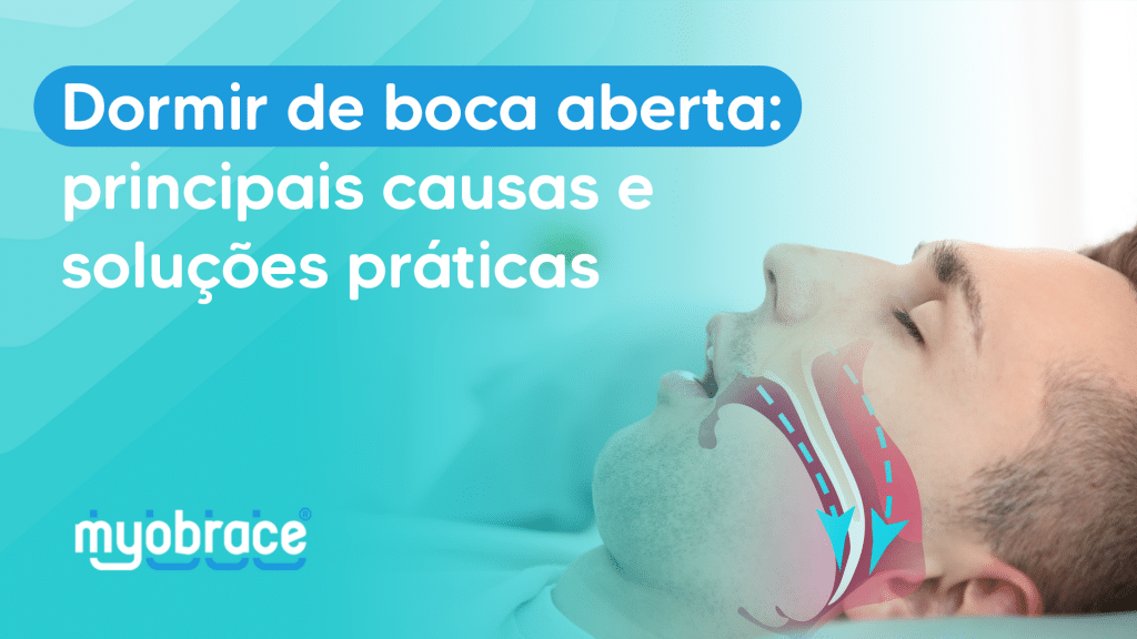 dormir de boca aberta, como parar de dormir com a boca aberta, bebe dorme de boca aberta, porque dormimos de boca aberta, como parar de dormir de boca aberta, dormir de boca aberta tratamento