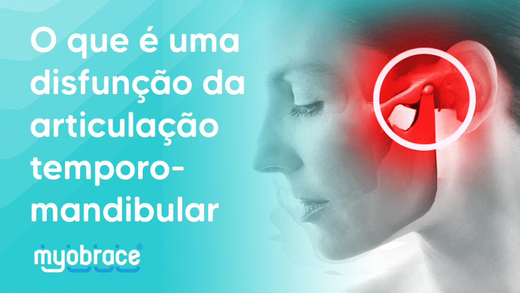 articulação temporomandibular, articulação temporomandibular atm, o que é atm, dor na atm, temporomandibular, mandibula, atm significado, atm sintomas, atm inflamada sintomas, bruxismo, odontologia miofuncional, Myobrace atm, atm o que é, mandíbula atm dentista, odontologia atm, significado de atm