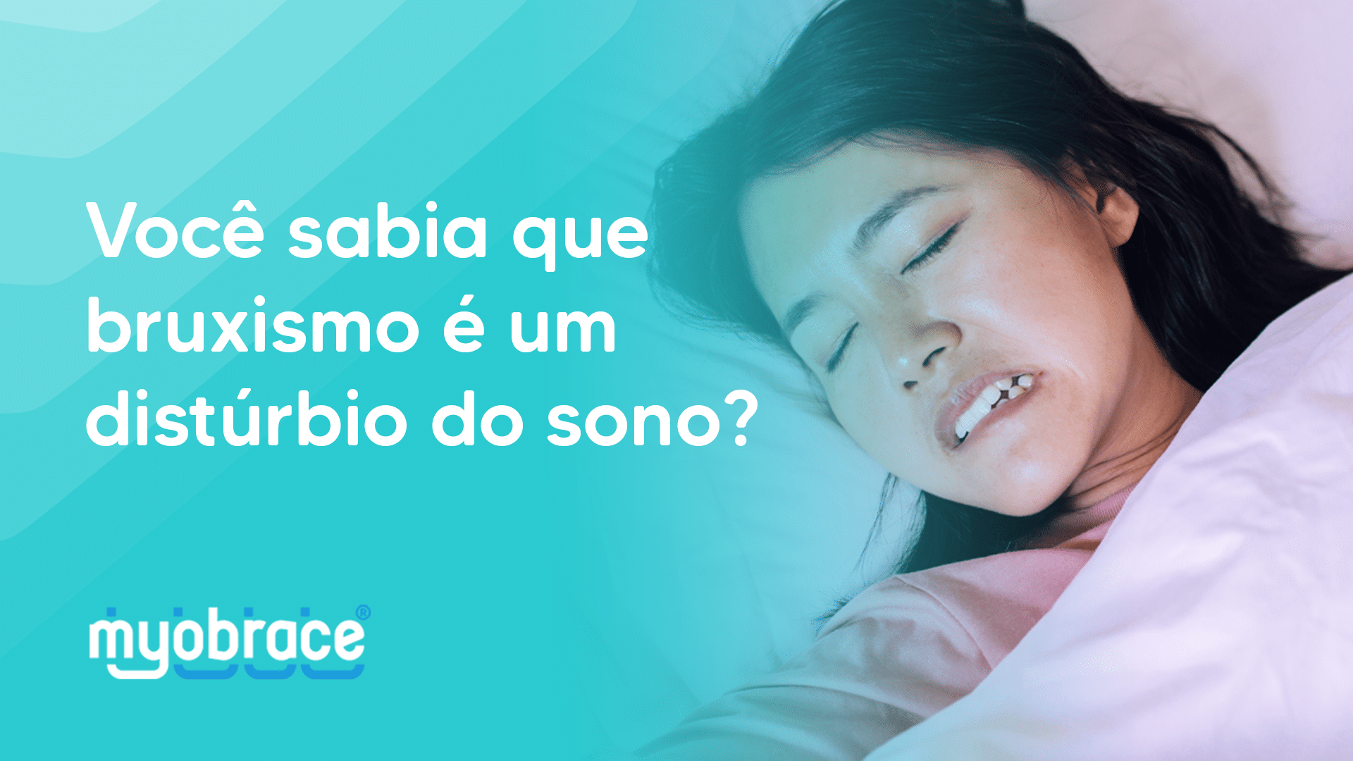 bruxismo, o que é disturbio do sono, disturbios do sono infantil, disturbio do sono sintomas, disturbio do sono o que é, placa de bruxismo, o que é bruxismo, bruxismo sintomas, bruxismo noturno, bruxismo dentario